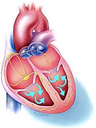 Heart Ejection Fraction Measurement for Heart Disease Prevention